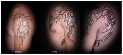 Tattoos