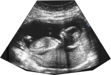 Ultrasound Scan in Dundalk