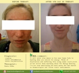 Bio Energy Therapy available in Cork, Ireland