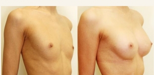 Plastic Surgery consultations with Dr Vygintas Kaikaris 7th/8th November