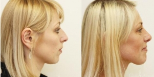 Plastic Surgery consultations with Dr Vygintas Kaikaris 7th/8th November