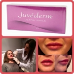 Botox/Fillers in Dublin