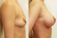 Plastic Surgeon Consultations in Moda Donna Beauty Clinic 13th & 14th of March