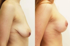 Plastic Surgeon Consultations in Moda Donna Beauty Clinic 13th & 14th of March