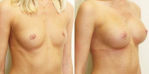 Plastic Surgeon Consultations in Moda Donna Beauty Clinic 13th & 14th of March