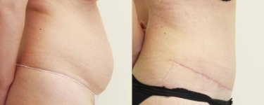 Plastic Surgeon Consultations in Moda Donna Beauty Clinic 13th & 14th of March
