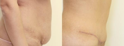 Plastic Surgeon Consultations in Moda Donna Beauty Clinic 13th & 14th of March