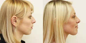 Plastic Surgeon Consultations in Moda Donna Beauty Clinic 13th & 14th of March