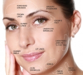 Anti-Wrinkle and Dermal Fillings(botox) FREE CONSULTATION