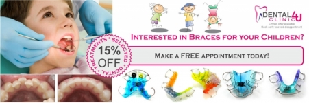 Interested in Braces for your Children?