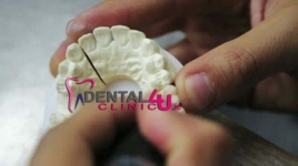 Odontologijos klinikoje Clinic4U.ie Konsultuojame vaikus ir suaugusius visais su dantų gydymu susijusiais klausimais.