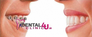 Odontologijos klinikoje Clinic4U.ie Dubline daromos Rentgeno paprastos bei panoramines nuotraukos