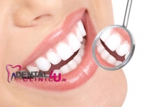 Estetinis plombavimas, atstatant dantų anatominę formą