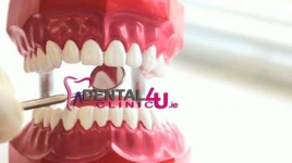 Pagrindinės dantų rovimo priežastys: