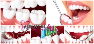 Dantų implantai ir implantavimas Dubline pigiausomis kainomis