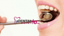 Имплантация зубов, импланты, стоматологическая хирургия Дублинe