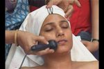 skin care & electrical facial treatment