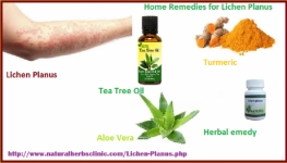 Natural Home Remedies for Lichen Planus