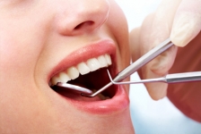 Dental Crown In Plainfield, IL By Expert & Experienced Dentists