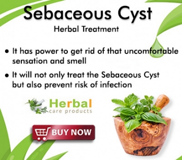 Herbal Treatment for Sebaceous Cyst